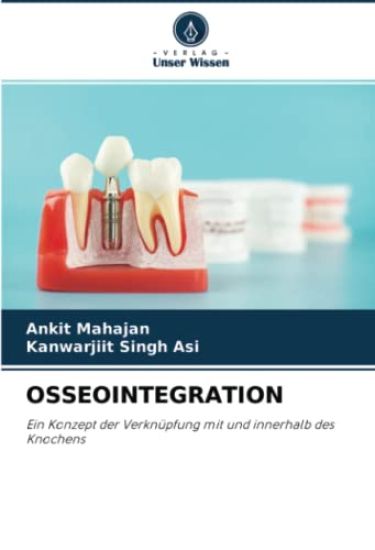 OSSEOINTEGRATION