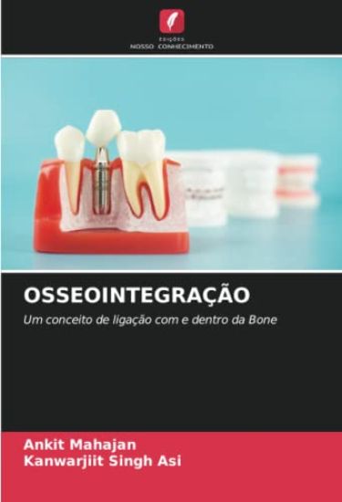 OSSEOINTEGRAÇÃO