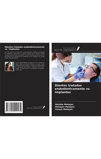 Dientes tratados endodónticamente vs. Implantes