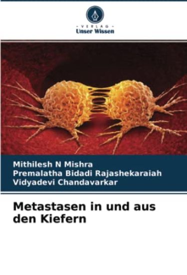 Metastasen in und aus den Kiefern