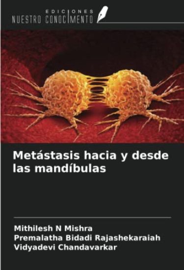 Metástasis hacia y desde las mandíbulas