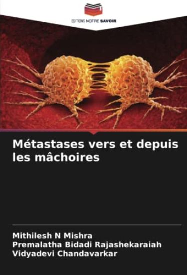 Métastases vers et depuis les mâchoires