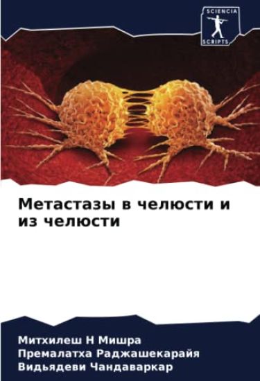 Metastazy w chelüsti i iz chelüsti