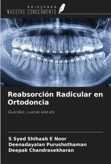 Reabsorción Radicular en Ortodoncia