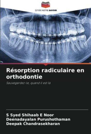 Résorption radiculaire en orthodontie