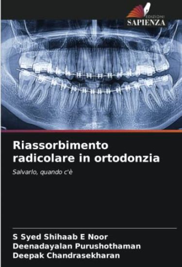 Riassorbimento radicolare in ortodonzia