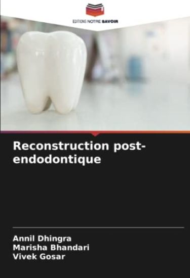 Reconstruction post-endodontique