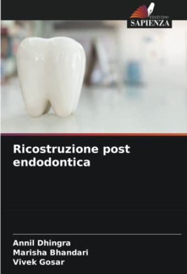 Ricostruzione post endodontica