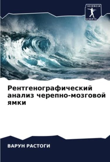 Rentgenograficheskij analiz cherepno-mozgowoj qmki