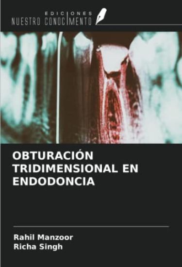 OBTURACIÓN TRIDIMENSIONAL EN ENDODONCIA