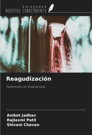 Reagudización