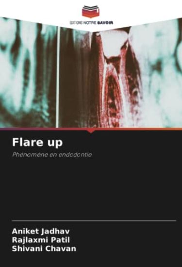 Flare up