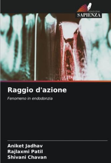 Raggio d'azione