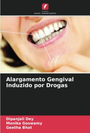 Alargamento Gengival Induzido por Drogas