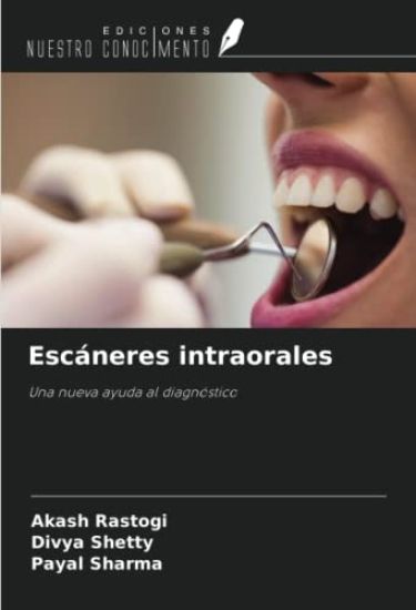 Escáneres intraorales