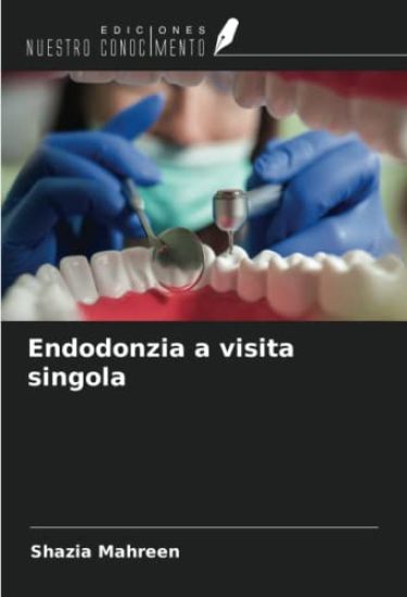 Endodonzia a visita singola