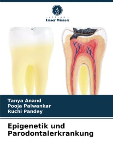 Epigenetik und Parodontalerkrankung