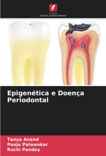 Epigenética e Doença Periodontal