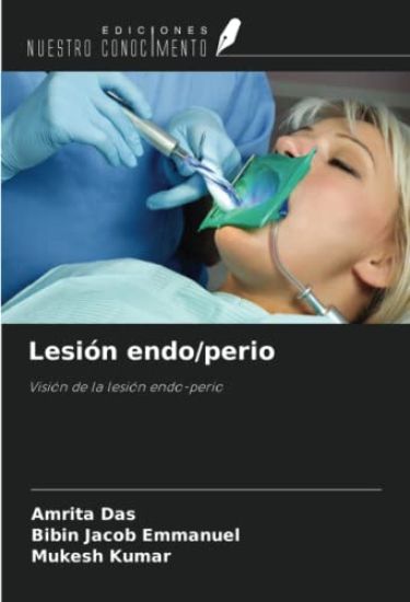 Lesión endo/perio