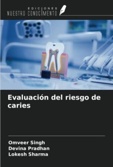 Evaluación del riesgo de caries