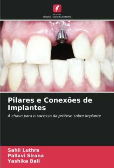 Pilares e Conexões de Implantes