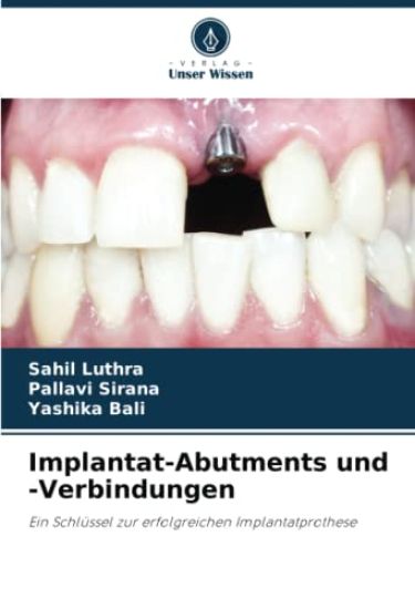 Implantat-Abutments und -Verbindungen