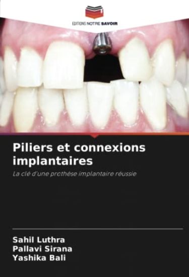 Piliers et connexions implantaires