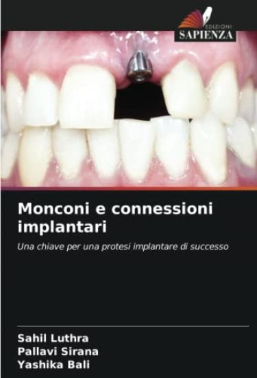 Monconi e connessioni implantari