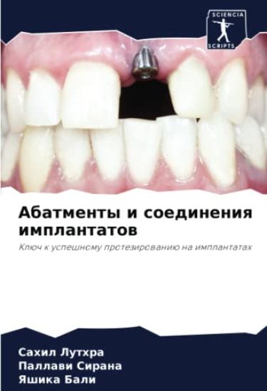 Abatmenty i soedineniq implantatow