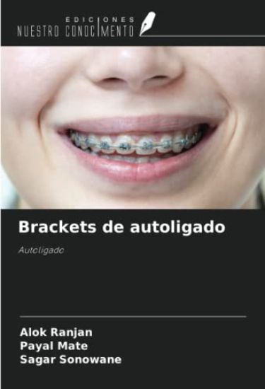 Brackets de autoligado