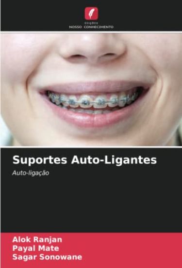 Suportes Auto-Ligantes – Alok Ranjan, kirjan kansikuva