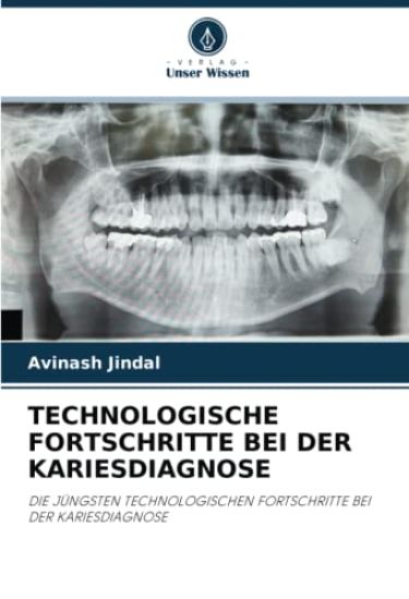 TECHNOLOGISCHE FORTSCHRITTE BEI DER KARIESDIAGNOSE