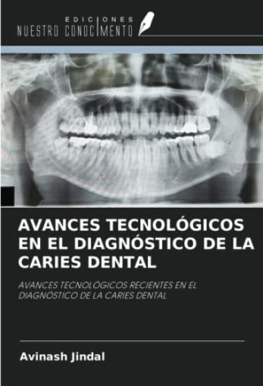 AVANCES TECNOLÓGICOS EN EL DIAGNÓSTICO DE LA CARIES DENTAL