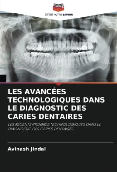 LES AVANCÉES TECHNOLOGIQUES DANS LE DIAGNOSTIC DES CARIES DENTAIRES