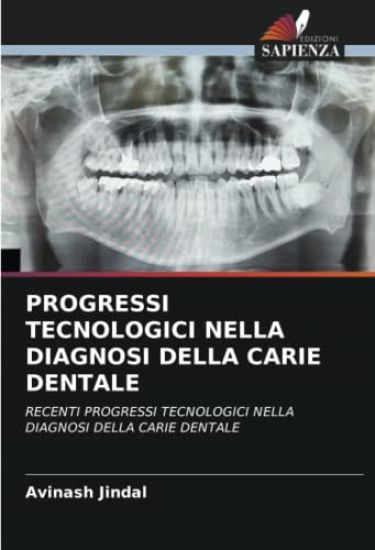 PROGRESSI TECNOLOGICI NELLA DIAGNOSI DELLA CARIE DENTALE
