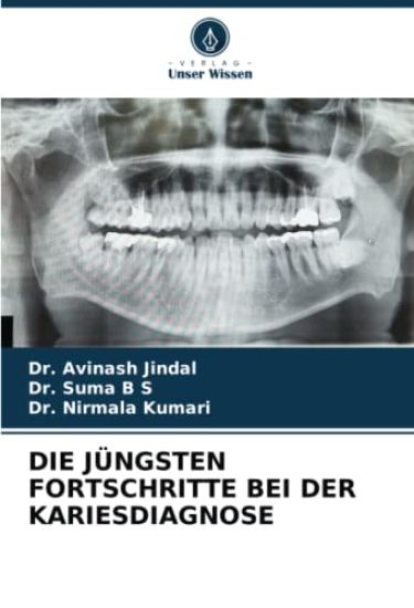 DIE JÜNGSTEN FORTSCHRITTE BEI DER KARIESDIAGNOSE