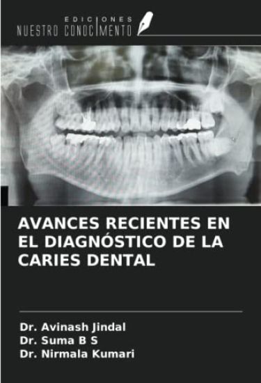 AVANCES RECIENTES EN EL DIAGNÓSTICO DE LA CARIES DENTAL