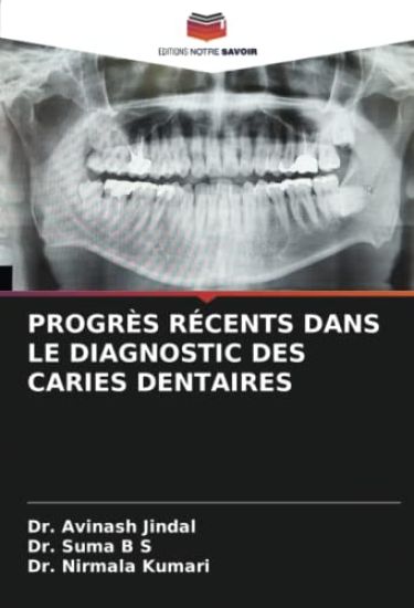 PROGRÈS RÉCENTS DANS LE DIAGNOSTIC DES CARIES DENTAIRES