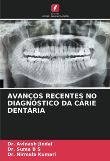 AVANÇOS RECENTES NO DIAGNÓSTICO DA CÁRIE DENTÁRIA