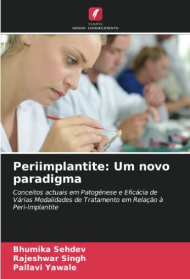 Periimplantite: Um novo paradigma – Bhumika Sehdev, kirjan kansikuva