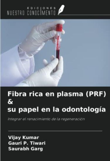 Fibra rica en plasma (PRF) & su papel en la odontología – Vijay Kumar, kirjan kansikuva