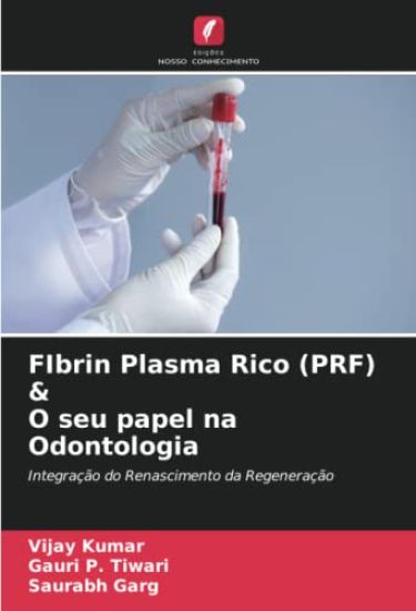 FIbrin Plasma Rico (PRF) & O seu papel na Odontologia – Vijay Kumar, kirjan kansikuva