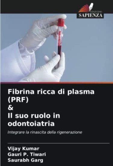 Fibrina ricca di plasma (PRF) & Il suo ruolo in odontoiatria – Vijay Kumar, kirjan kansikuva