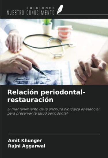 Relación periodontal-restauración