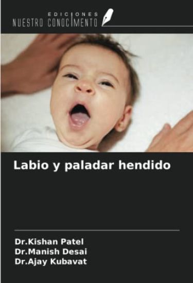 Labio y paladar hendido