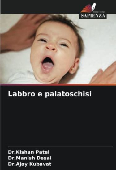 Labbro e palatoschisi