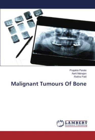 Malignant Tumours Of Bone