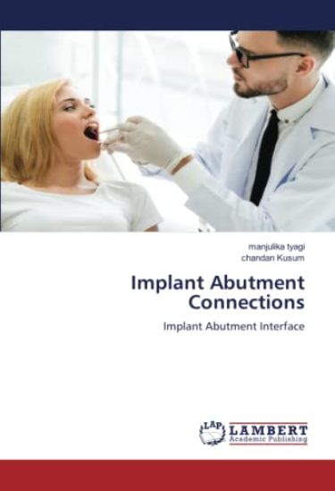Implant Abutment Connections