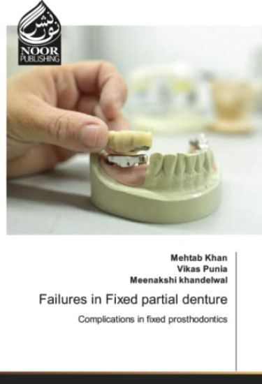 Failures in Fixed partial denture