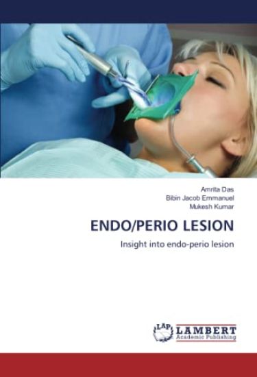 ENDO/PERIO LESION